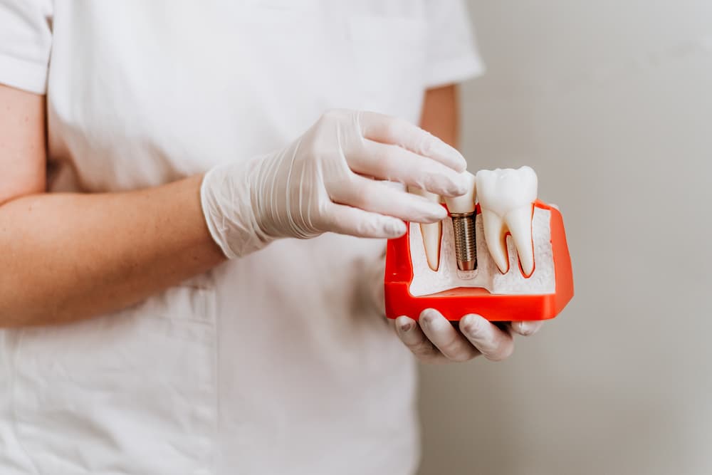 人工牙根是什麼？植牙一定要裝人工牙根嗎？