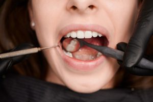 macro photography of a beautiful female smile with 2022 05 30 22 50 55 utc 1
