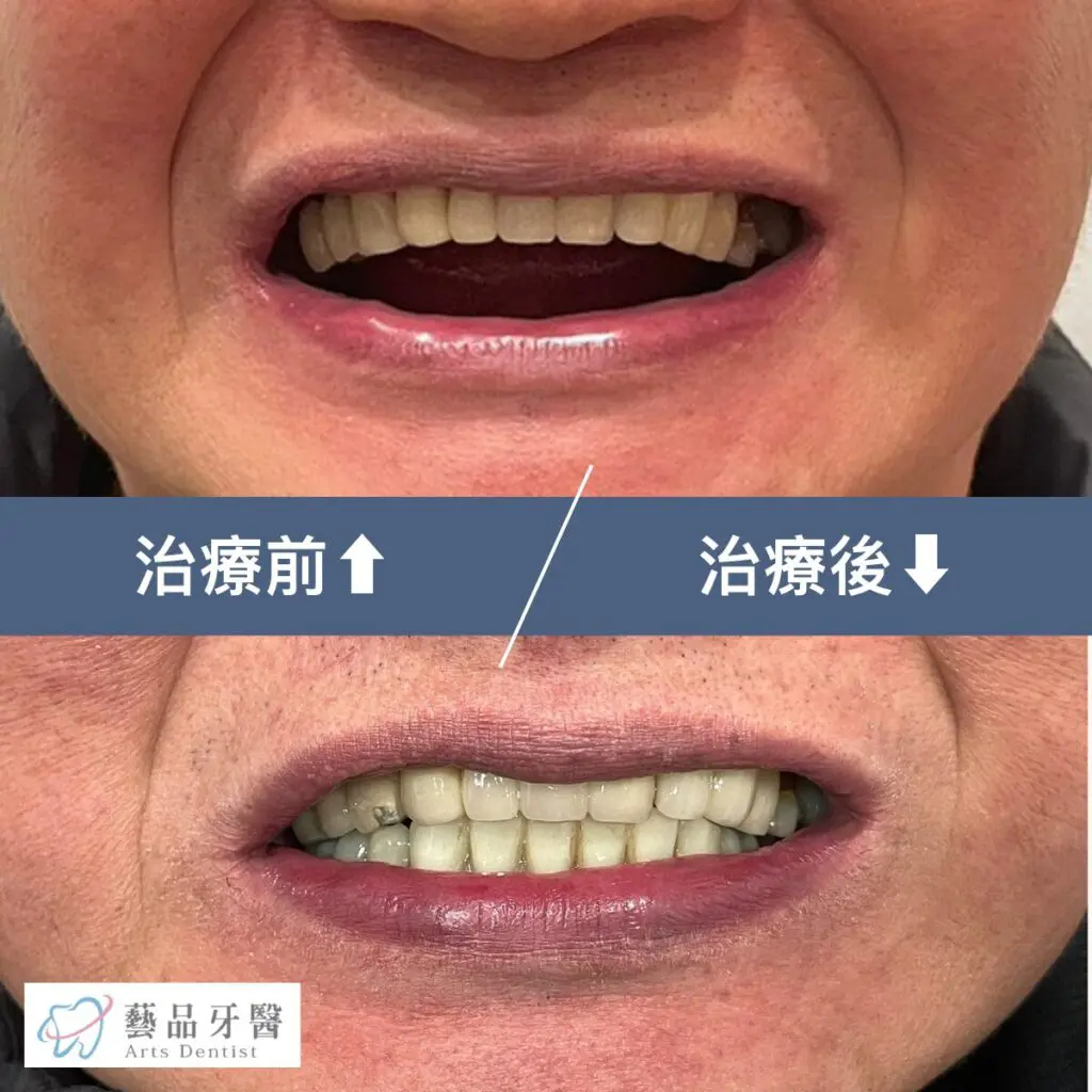 artsdental case 1