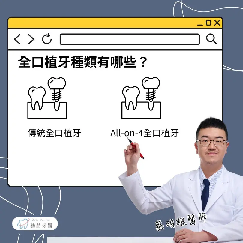全口植牙要多少錢?ptt鄉民都在討論的全口植牙價格 1 全口植牙的種類
