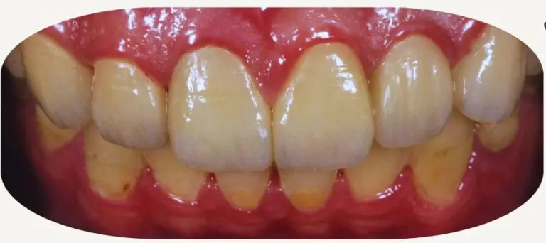artsdental 1 1 1 e1721381865627