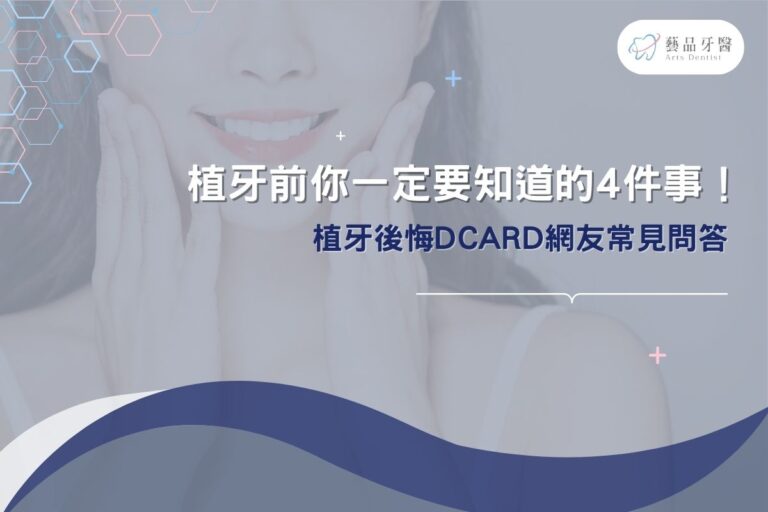 植牙前你一定要知道的4件事！植牙後悔dcard網友常見問答