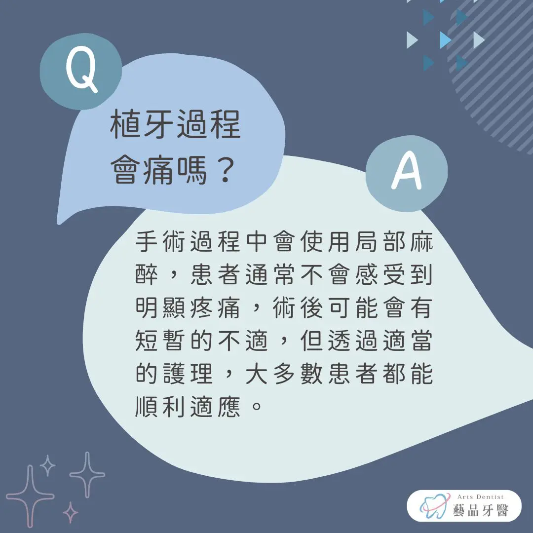 植牙過程全解析:植牙過程要多久?會痛嗎?過渡期怎麼辦? 3 說明植牙過程會痛嗎?