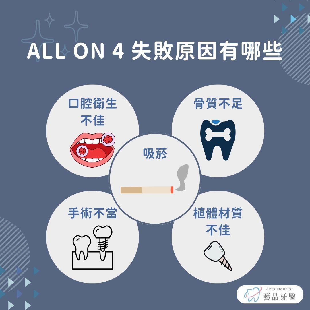 all on 4失敗原因有什麼？