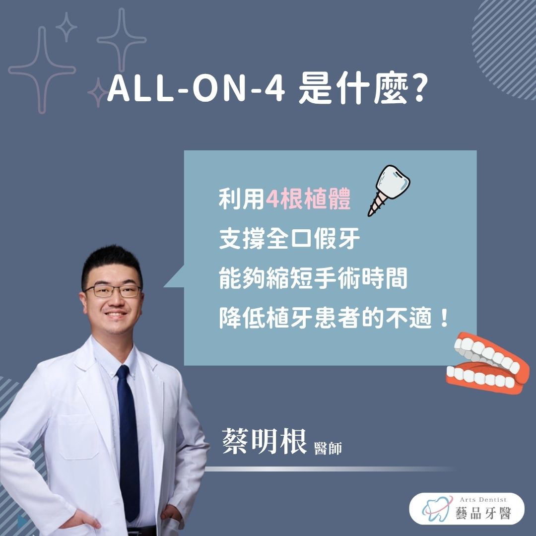 all-on-4是什麼？