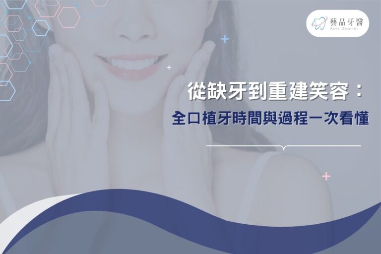 從缺牙到重建笑容：全口植牙時間與過程一次看懂