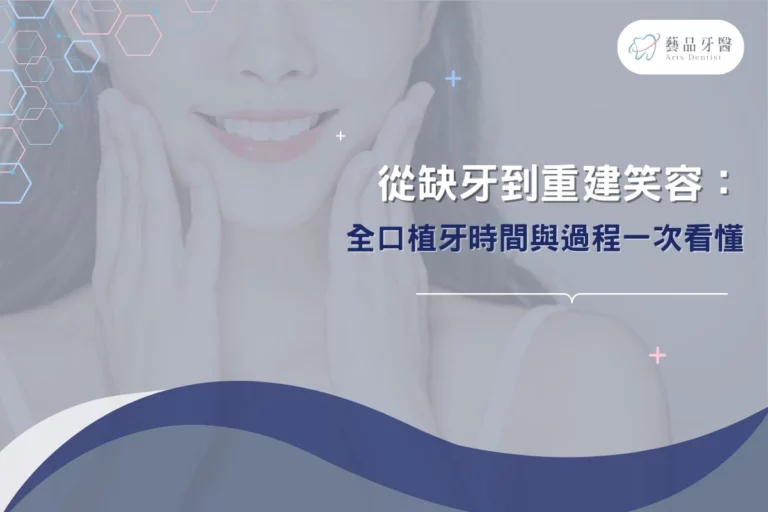 從缺牙到重建笑容:全口植牙時間與過程一次看懂 2 從缺牙到重建笑容:全口植牙時間與過程一次看懂