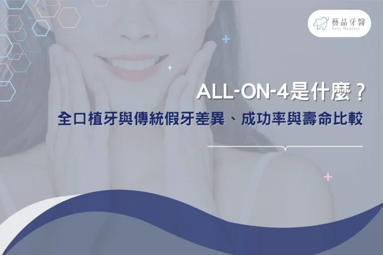 All-on-4是什麼?全口植牙與傳統假牙差異、成功率與壽命比較 1 All-on-4是什麼?全口植牙與傳統假牙差異、成功率與壽命比較