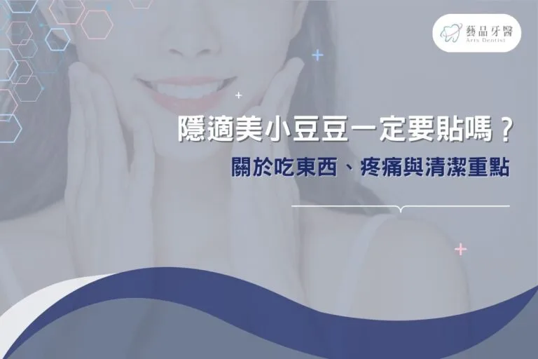 隱適美小豆豆一定要貼嗎?關於吃東西、疼痛與清潔重點 8 隱適美小豆豆一定要貼嗎?關於吃東西、疼痛與清潔重點
