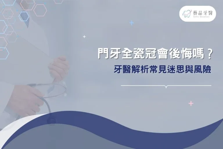 門牙全瓷冠會後悔嗎?牙醫解析常見迷思與風險 4 門牙全瓷冠會後悔嗎?牙醫解析常見迷思與風險