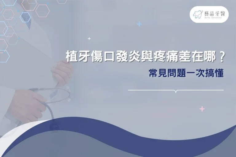 植牙傷口發炎與疼痛差在哪?常見問題一次搞懂 1 植牙傷口發炎與疼痛差在哪?常見問題一次搞懂