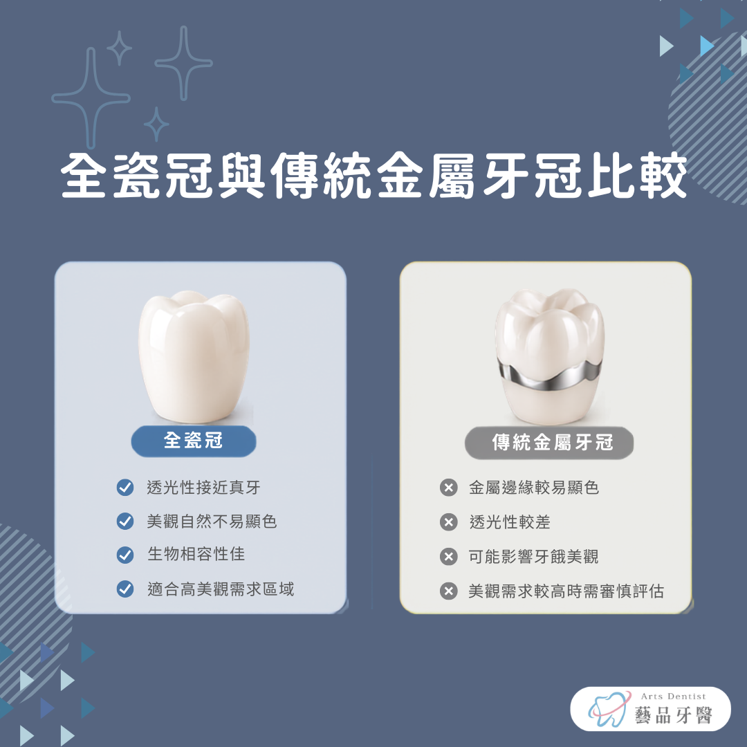 全瓷冠與傳統金屬牙冠在透光性、美觀及生物相容性上的比較
