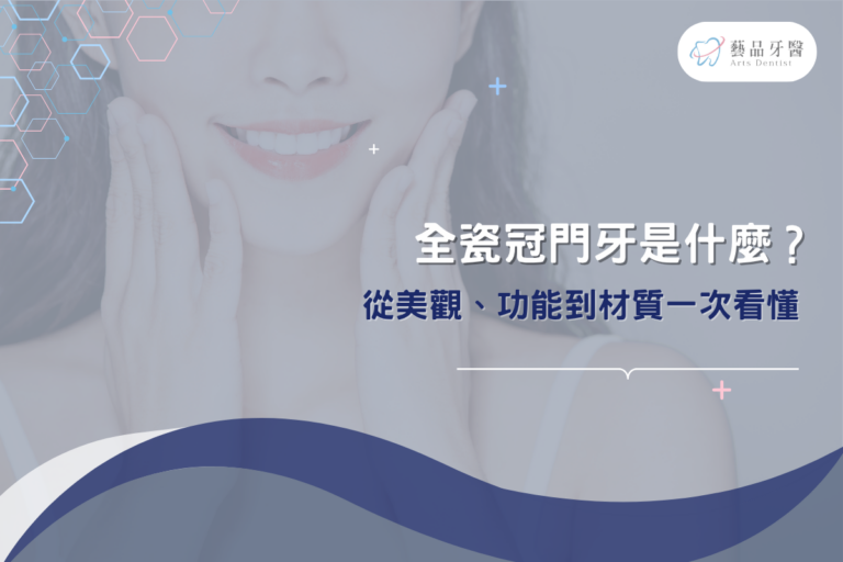 dont neglect post dental implant care 1