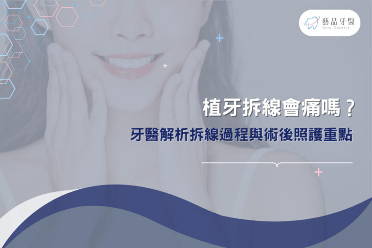 植牙拆線會痛嗎?牙醫解析拆線過程與術後照護重點 4 dont neglect post dental implant care