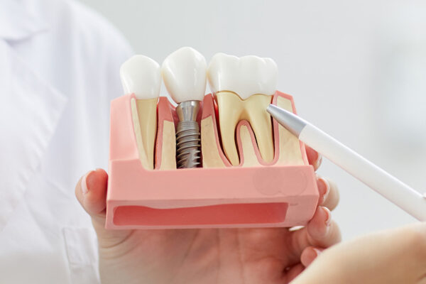 bone-regeneration-1