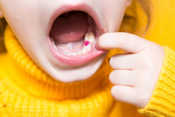 colored-purple-filling-on-the-girl-s-milk-chewing-2022-01-12-08-13-51-utc (1)