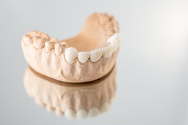 model-of-artificial-jaw-with-veneers-2021-09-01-14-47-53-utc (1)
